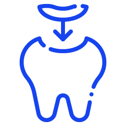 Full Mouth Rehabilitation